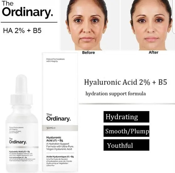 THE ORDINARY Niacinamide 10% + Zinc 1% 30ml