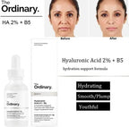 THE ORDINARY Niacinamide 10% + Zinc 1% 30ml